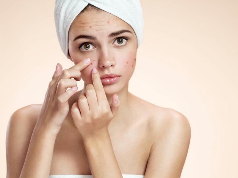 Can a Liver Cleanse Help with Skin Issues Like Acne or Eczema?
